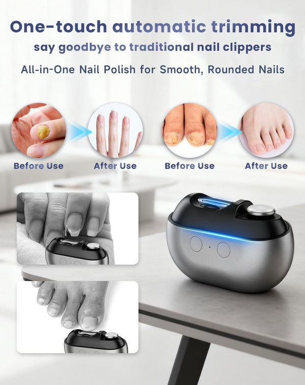 EasyClip Smart Nail Trimmer